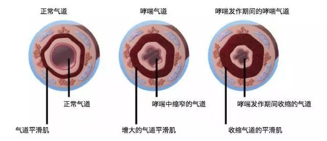 熱金屬噴涂粉塵污染